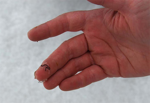 ice worms emerge in pacific northwest glaciers ice worms emerge in pacific northwest glaciers