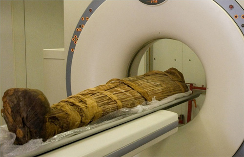 jpg Ancient people had clogged arteries, too, mummy CT scans show