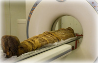 Ancient people had clogged arteries, too, mummy CT scans show 